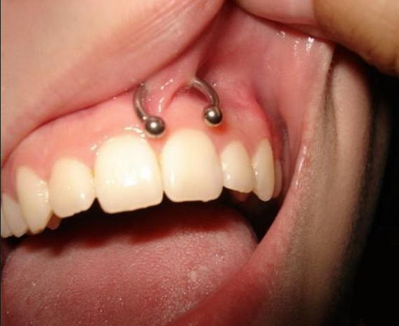 modas dentales _piercing frenillo